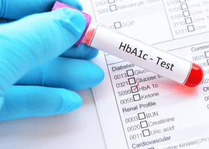 The A1C Test & Diabetes