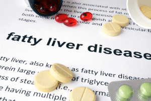Fatty Liver: One More Silent Killer